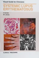 Cover of Systemic lupus erythematosus