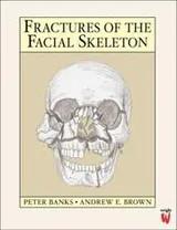 Cover of Fractures of the facial skeleton