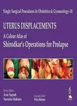 Cover of Single Surgical Procedures in Obstetrics and Gynaecology - 18 : UTERUS DISPLACEMENTS
