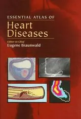 Cover of Essential Atlas of Heart Diseases