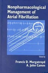 Cover of Nonpharmacological management of atrial fibrillation