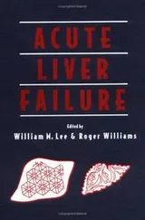 Cover of Acute Liver Failure