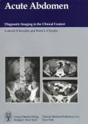 Cover of Acute abdomen