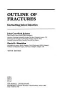 Cover of Outline of fractures
