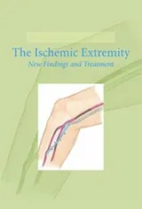 Cover of Modern Trends In Vascular Surgery Ischemic Extremities New Findings Treatment