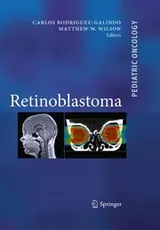 Cover of Retinoblastoma