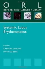 Cover of Systemic Lupus Erythematosus