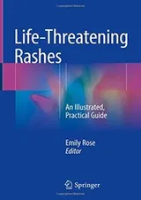 Cover of Life-Threatening Rashes