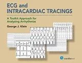 Cover of ECG and Intracardiac Tracings