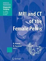 Cover of MRI and CT of the Female Pelvis
