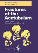 Cover of Fractures of the Acetabulum