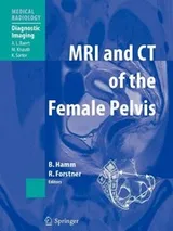 Cover of MRI and CT of the Female Pelvis