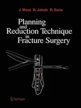 Cover of Planning and Reduction Technique in Fracture Surgery