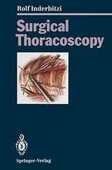 Cover of Surgical Thoracoscopy