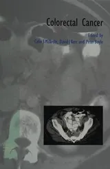 Cover of Colorectal cancer