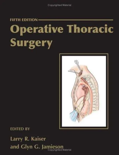 Cover of Operative Thoracic Surgery